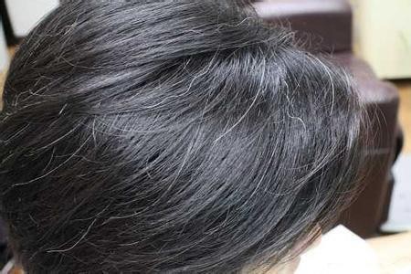 青少年白发主要是什么原因呢？