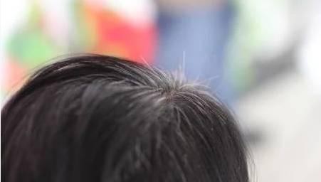 白头发长在不同的地方也有着不同的寓意