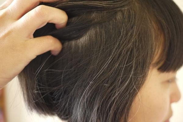 女性白发应该怎样减少