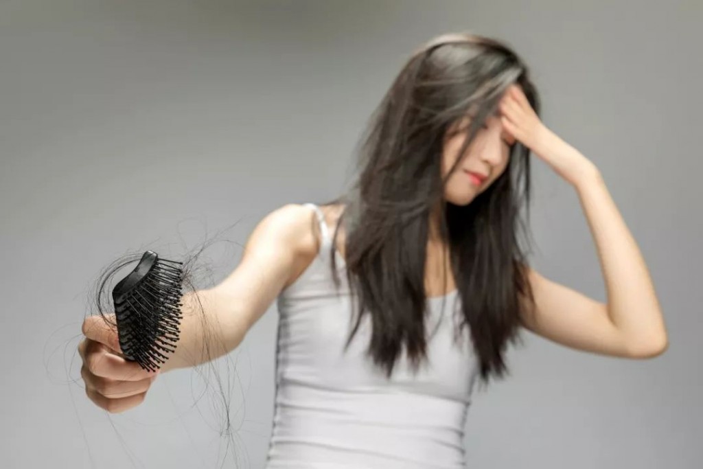 女性脱发要怎么办？