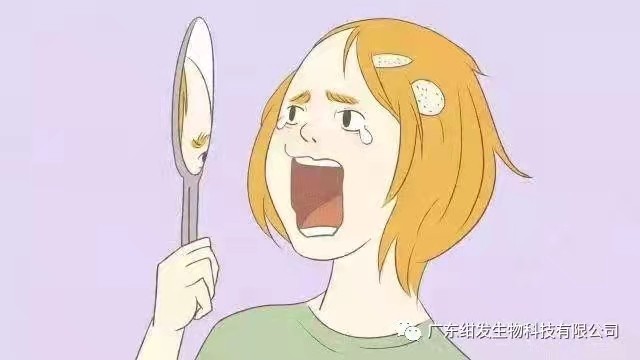 白发一族 | 斑秃只能束手无策？当然不！